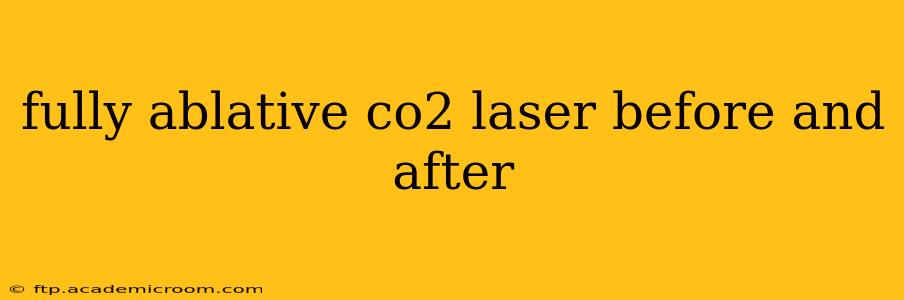 fully ablative co2 laser before and after