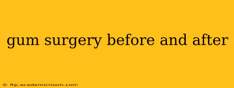 gum surgery before and after