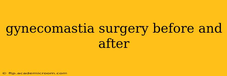 gynecomastia surgery before and after
