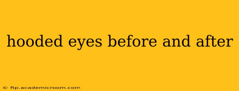 hooded eyes before and after
