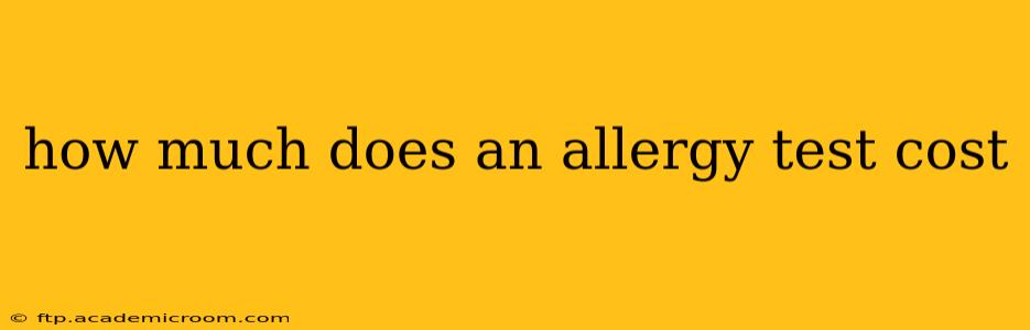 how much does an allergy test cost