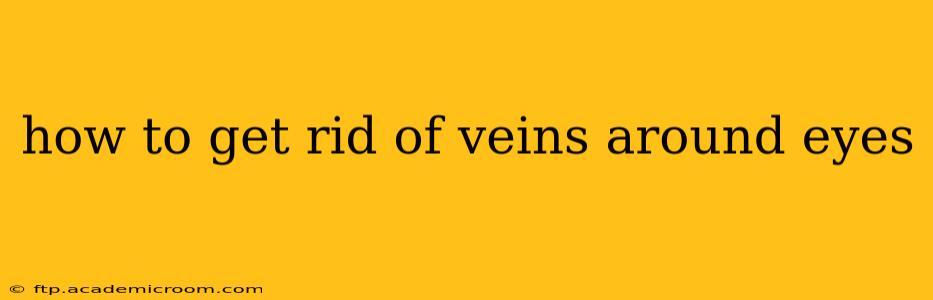 how to get rid of veins around eyes