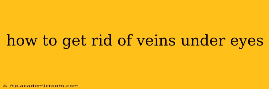 how to get rid of veins under eyes