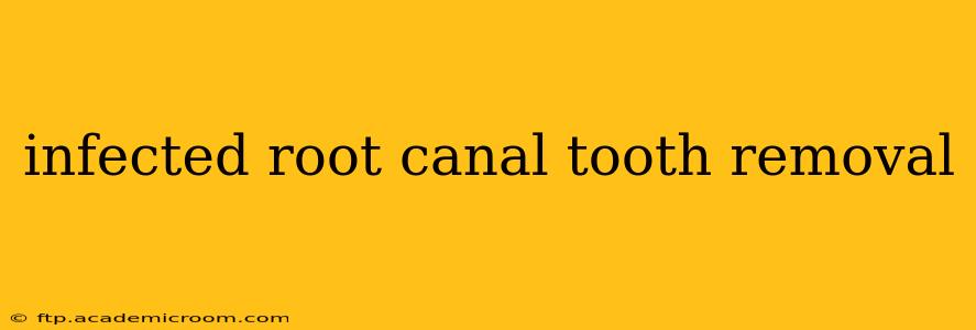 infected root canal tooth removal