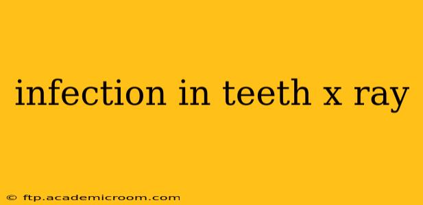 infection in teeth x ray