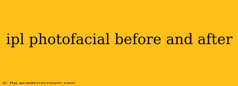 ipl photofacial before and after