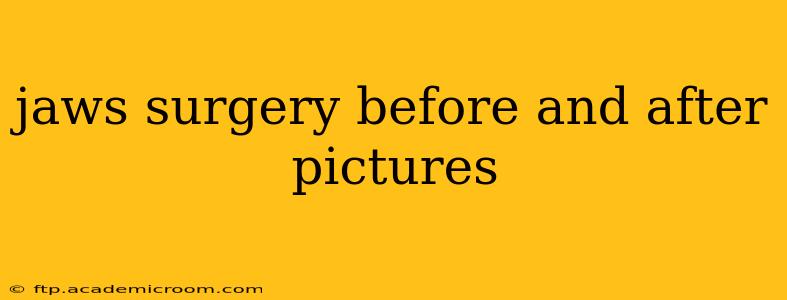 jaws surgery before and after pictures