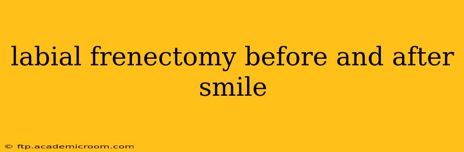labial frenectomy before and after smile