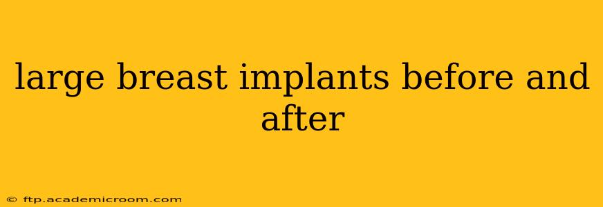 large breast implants before and after