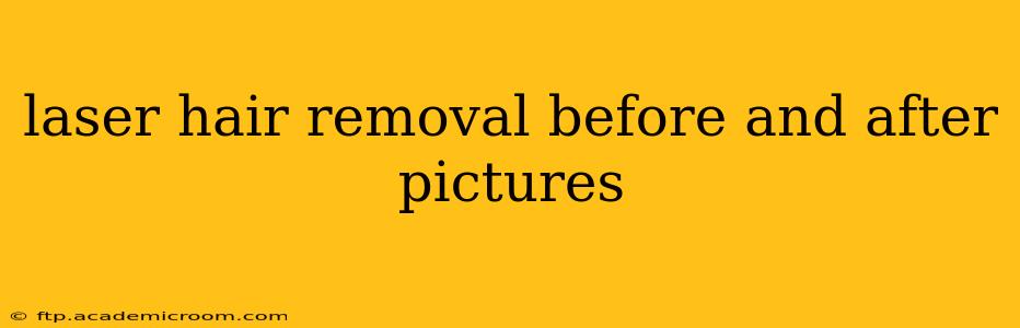 laser hair removal before and after pictures