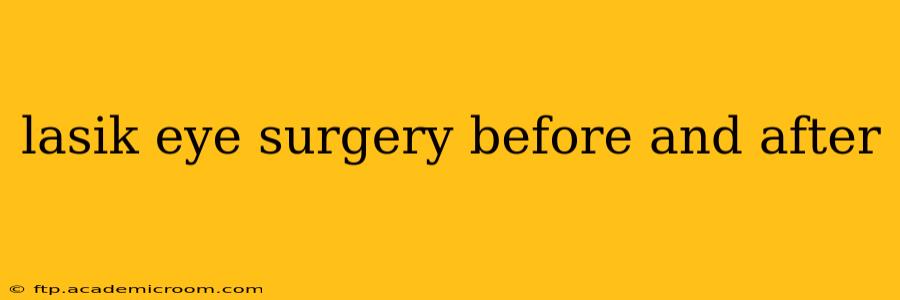 lasik eye surgery before and after