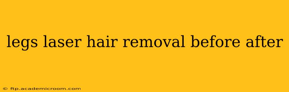 legs laser hair removal before after