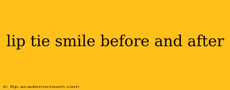 lip tie smile before and after