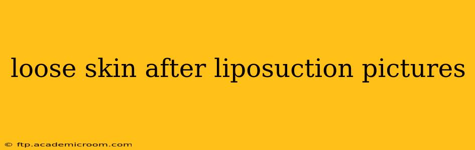 loose skin after liposuction pictures