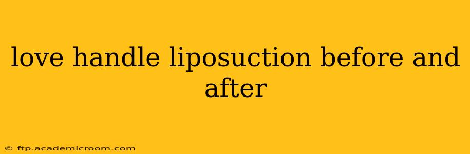 love handle liposuction before and after