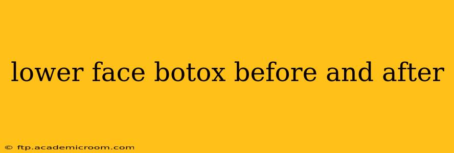lower face botox before and after