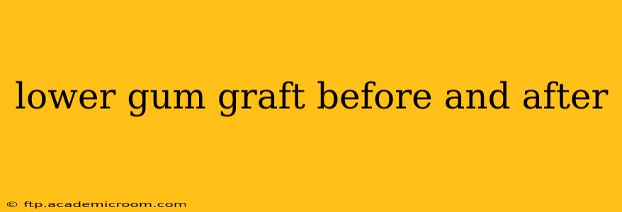 lower gum graft before and after