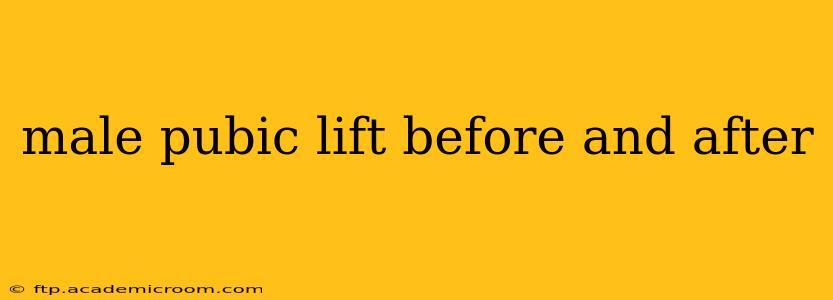male pubic lift before and after