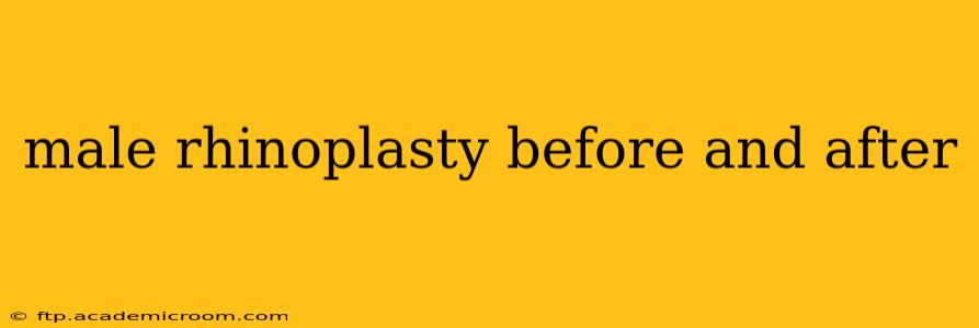 male rhinoplasty before and after