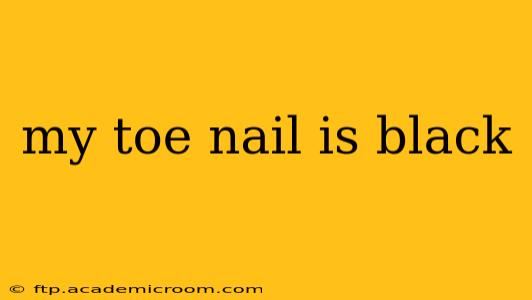 my toe nail is black