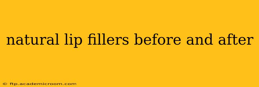 natural lip fillers before and after