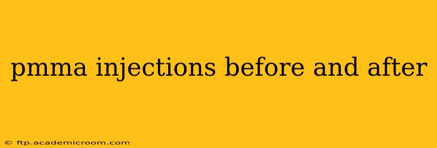 pmma injections before and after