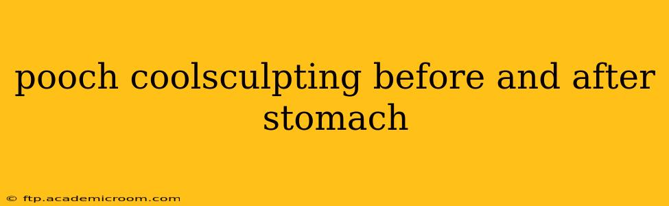 pooch coolsculpting before and after stomach