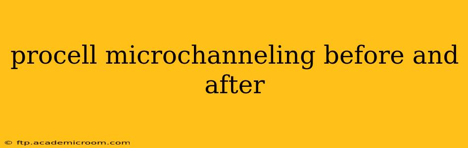procell microchanneling before and after