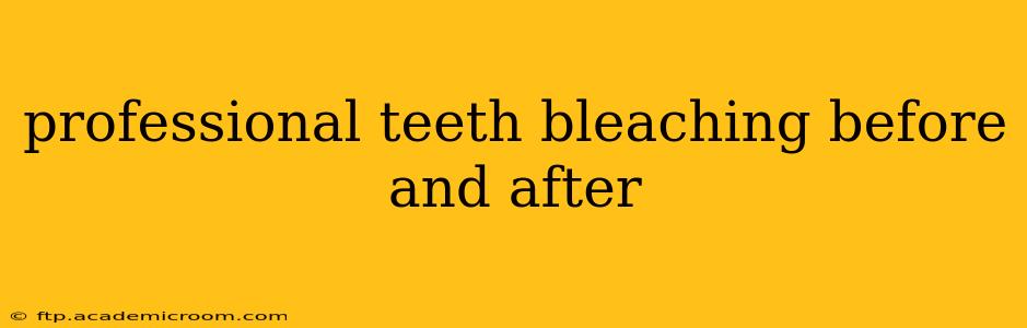 professional teeth bleaching before and after