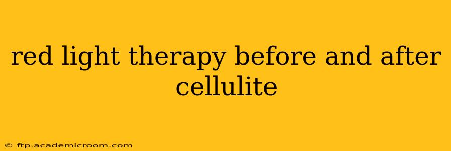 red light therapy before and after cellulite