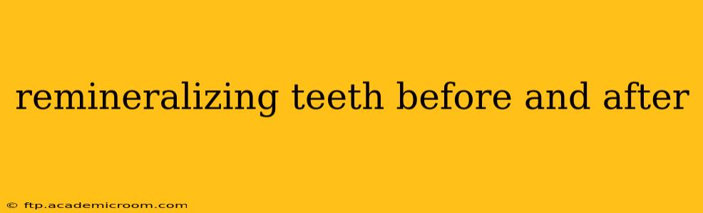 remineralizing teeth before and after