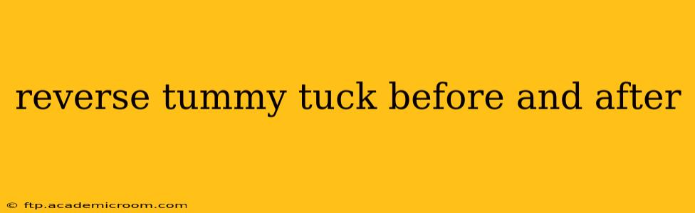 reverse tummy tuck before and after