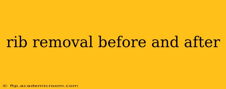 rib removal before and after