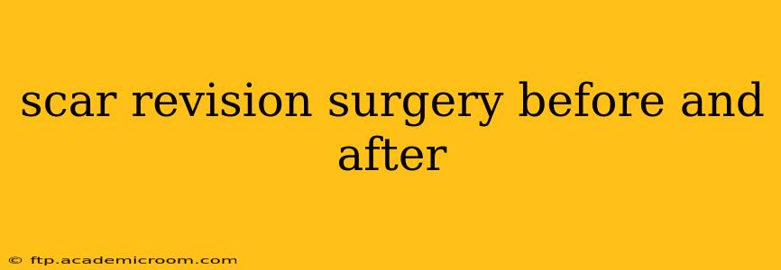 scar revision surgery before and after