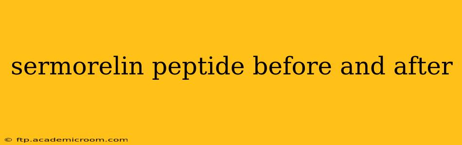 sermorelin peptide before and after