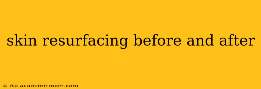 skin resurfacing before and after
