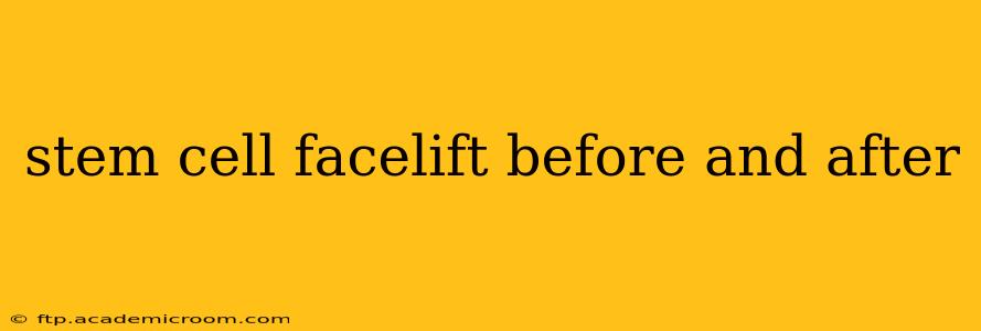 stem cell facelift before and after