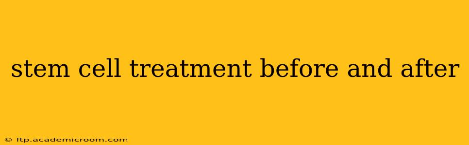 stem cell treatment before and after