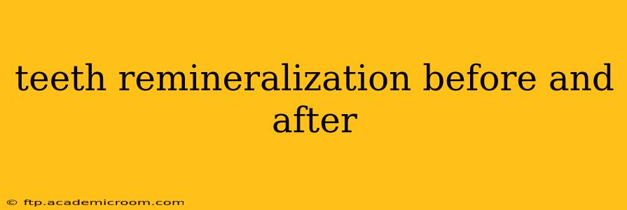 teeth remineralization before and after