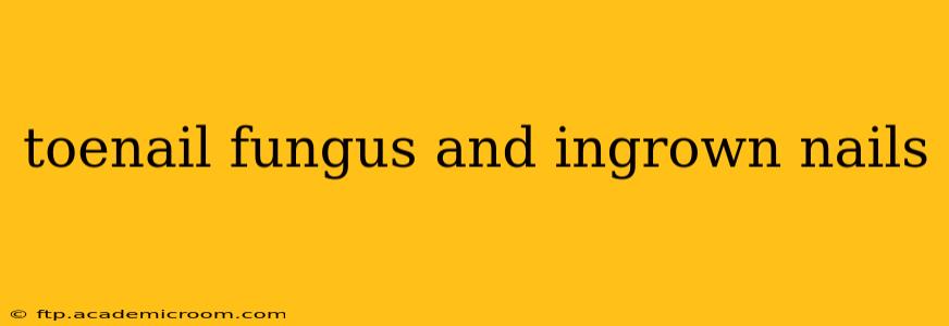 toenail fungus and ingrown nails