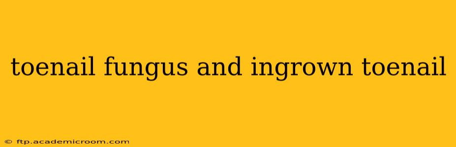toenail fungus and ingrown toenail