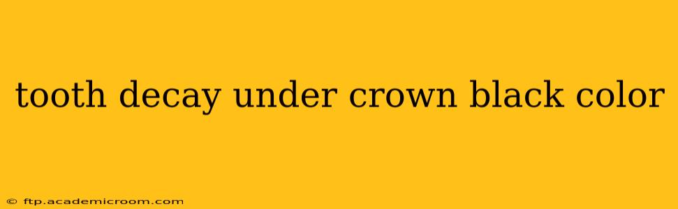 tooth decay under crown black color