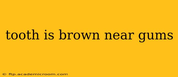 tooth is brown near gums
