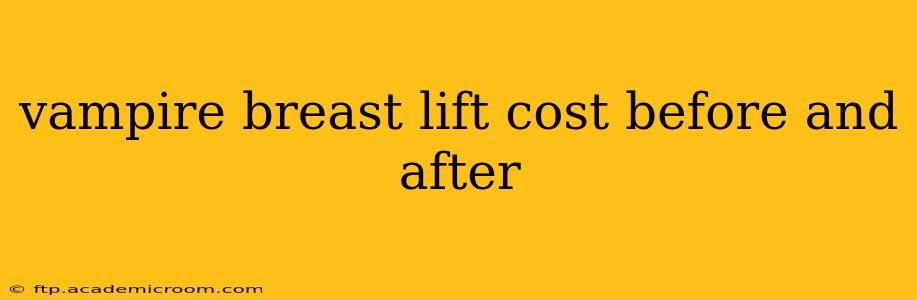 vampire breast lift cost before and after