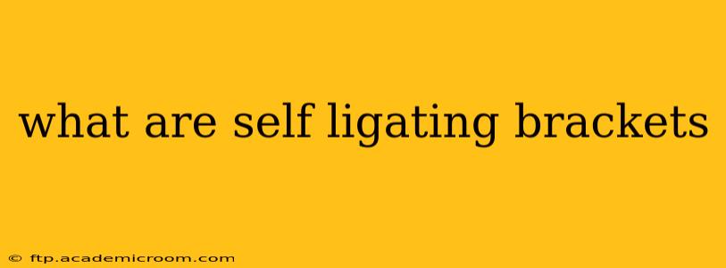 what are self ligating brackets