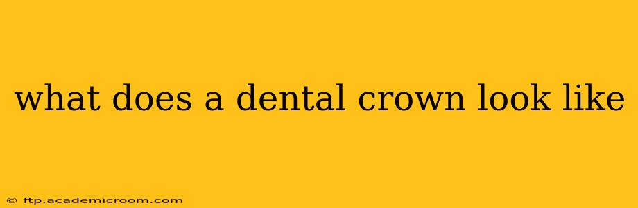 what does a dental crown look like