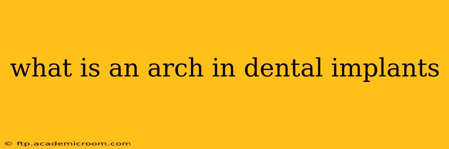 what is an arch in dental implants