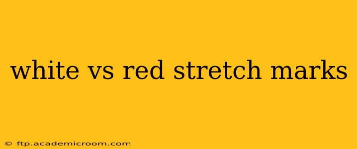 white vs red stretch marks