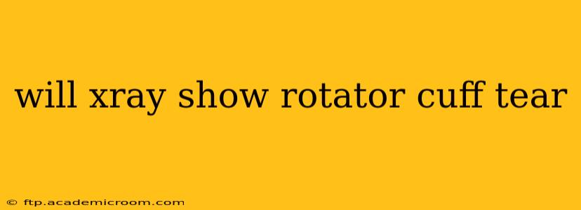 will xray show rotator cuff tear